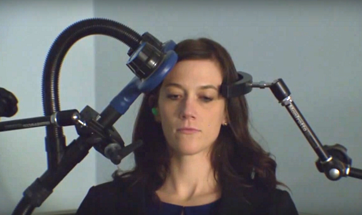 Transcranial Magnetic Simulation Therapy 